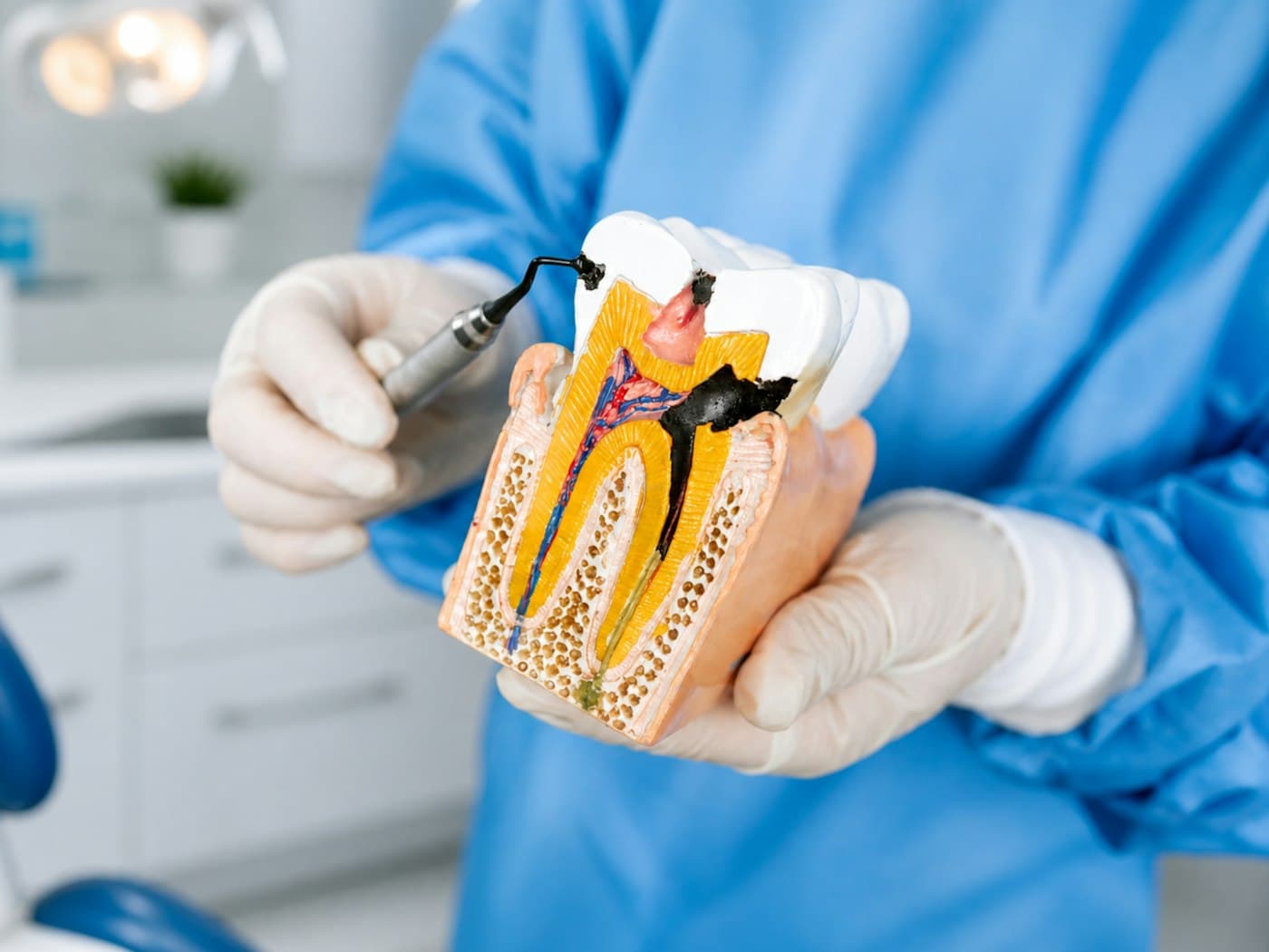 Dentist holding a model that shows the inside of a tooth
