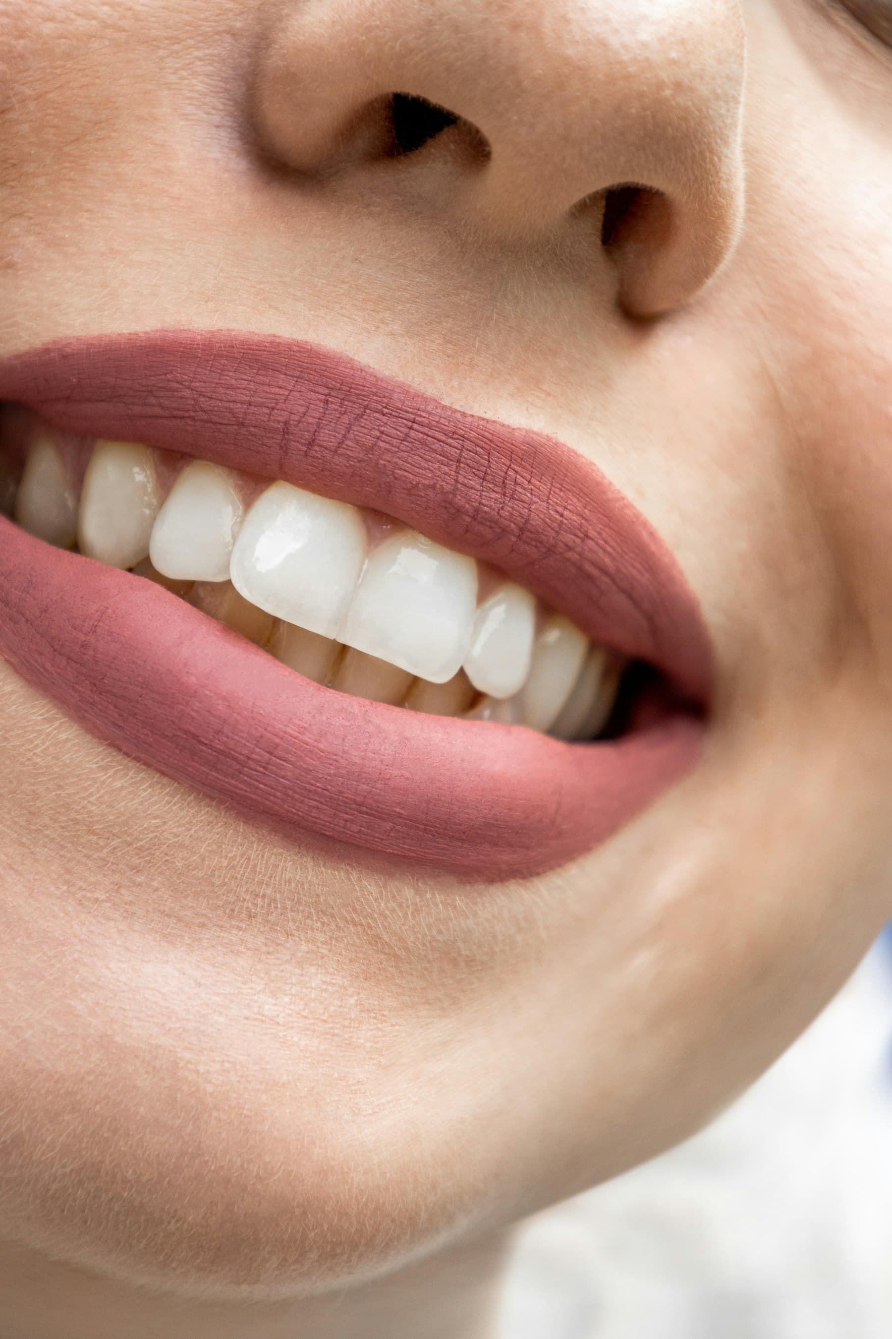 Close-up of a patient's smile, after treatment