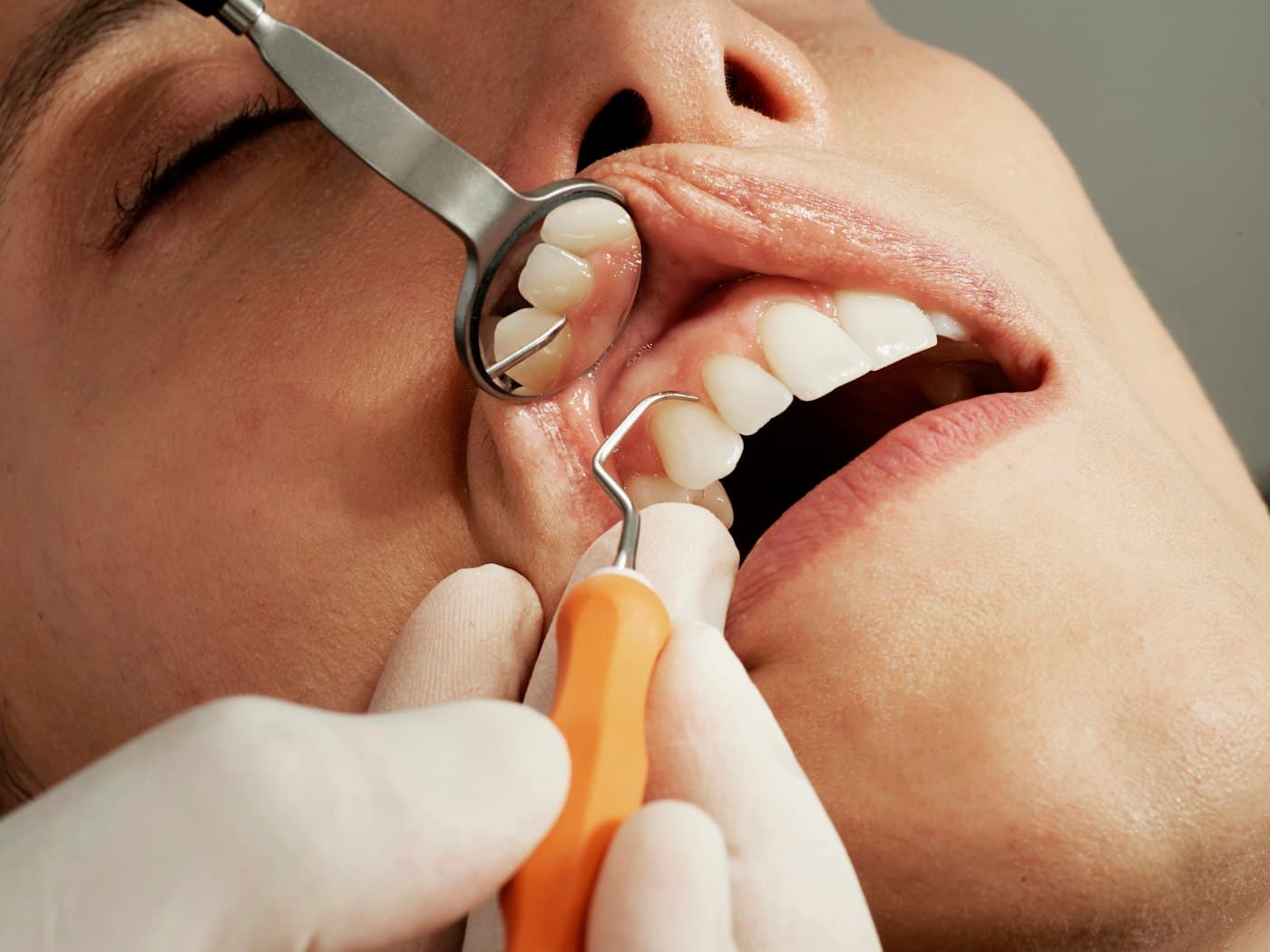 Dentist examining a patient's teeth with a mirror