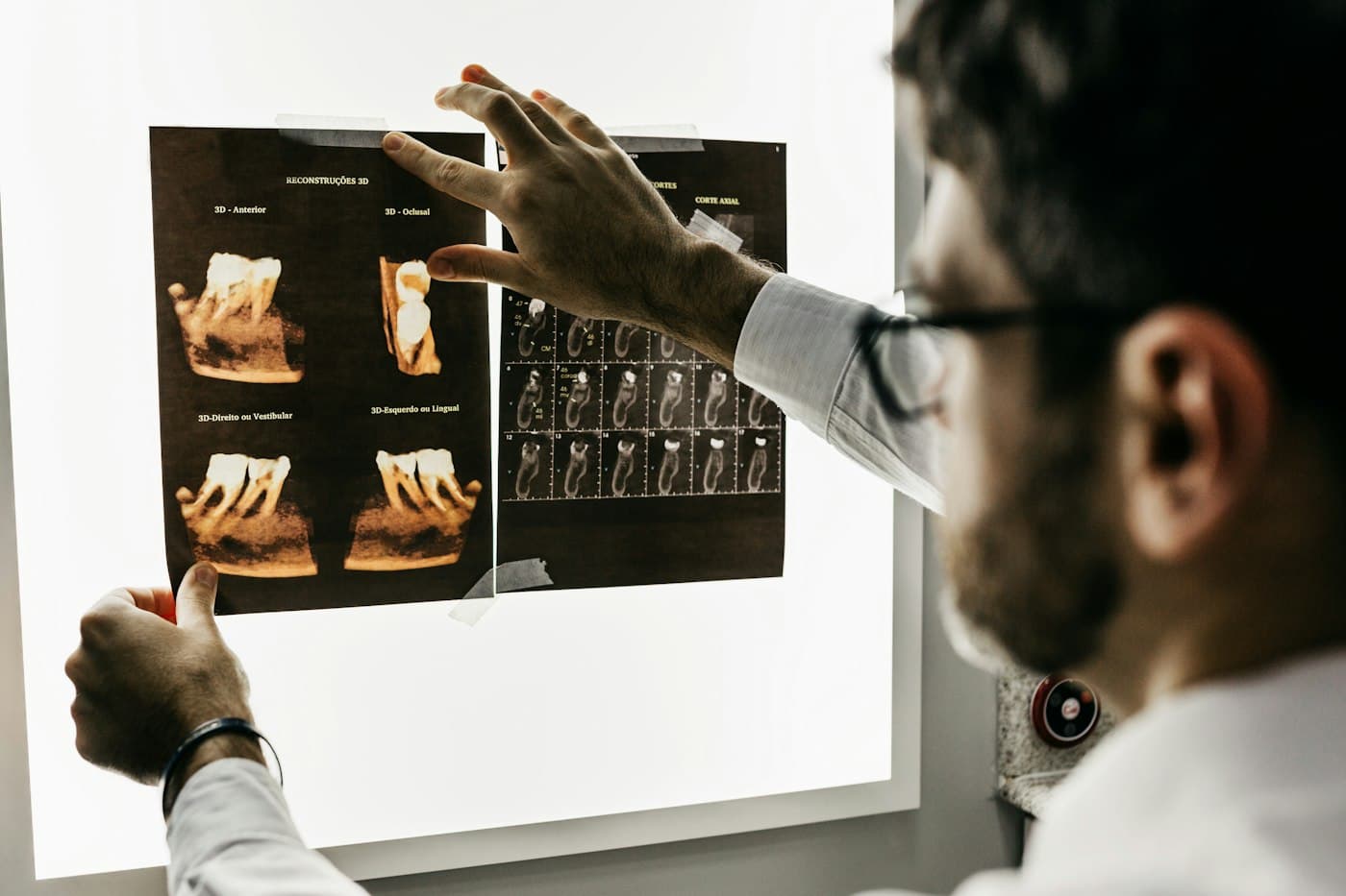 Dentist reviewing dental X-rays on a light board